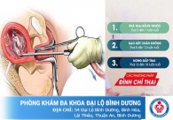 Phá thai an toàn – Phương pháp, chi phí và địa chỉ uy tín tại Bình Dương