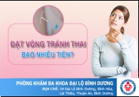 Đặt vòng tránh thai bao nhiêu tiền