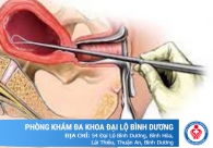 Cơ sở phá thai ở Bình Tân uy tín. Giá tiền phá thai tại Chuyên khoa hiện nay