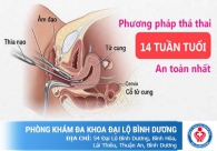 Trễ kinh 7 ngày, thai không mong muốn phải làm sao