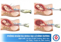 Phương pháp nạo phá thai không đau an toàn