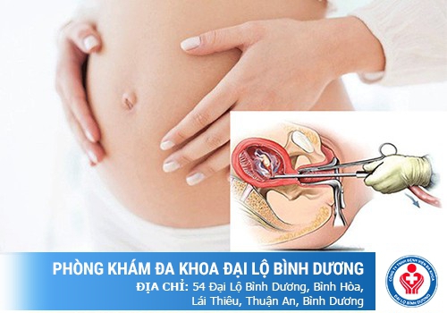 Phá thai 4 tháng tuổi có được không?