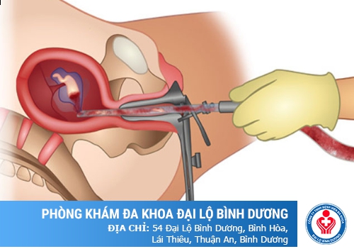 Phá thai 10 tuần bằng phương pháp gì an toàn và hồi phục nhanh?