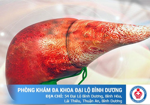 Chế độ ăn cho người bệnh gan mật