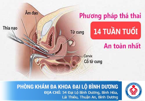 Phá thai 18 tuần