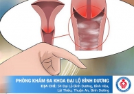 10 dấu hiệu báo động bạn mắc bệnh vùng kín nguy hiểm