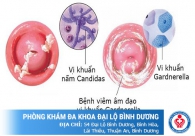 Những bệnh đường sinh dục nữ giới dễ mắc nhất