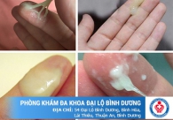 Khí hư có bọt là dấu hiệu của bệnh gì