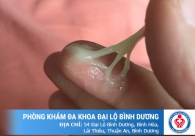 Khí hư trắng nhiều: Nguyên nhân và cách khắc phục