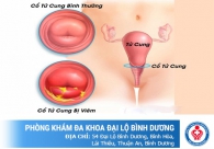 Những bệnh viêm đường sinh dục ở nữ giới