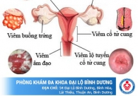 Giải pháp hiệu quả cho tình trạng viêm âm đạo hiện nay