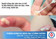 Cẩm nang về bệnh huyết trắng dành cho chị em