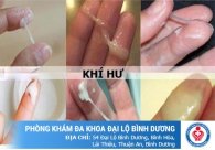 Ra khí hư màu vàng có nguy hiểm không