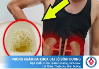 Thận trọng với triệu chứng tiểu khó ở chị em