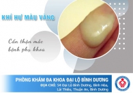 Khí hư, huyết trắng màu vàng là dấu hiệu bệnh phụ khoa gì?