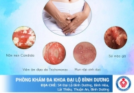 Bị ngứa vùng kín nữ phải làm sao để hết nhanh và không tái lại?