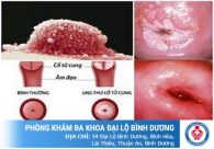 Ra dịch âm đạo màu nâu ở phụ nữ có sao không