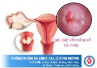 Những căn bệnh phụ nữ phổ biến hiện nay