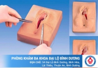 Có nên thu hẹp âm đạo sau sinh hay không