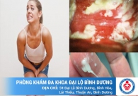 Làm sao để hết nấm ngứa vùng kín mà không bị tái đi tái lại?