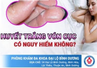 Huyết trắng vón cục và ngứa phải chữa trị như thế nào?
