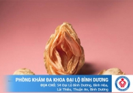 Review địa chỉ chất lượng và kinh nghiệm cắt môi bé vùng kín tại Bình Dương