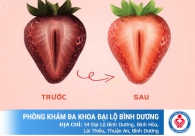 Âm đạo thâm đen - Thủ phạm gây mất hứng khi yêu
