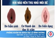 Tiểu phẫu cắt mép môi bé giúp chị em phụ nữ tự tin hơn