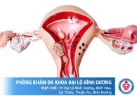 Phương pháp chữa trị viêm âm đạo hiệu quả