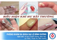 Bệnh khí hư và dấu hiệu nhận biết