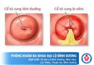 Nguyên nhân gây viêm cổ tử cung ở nữ giới
