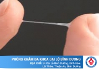 Cách nhận biết khí hư bình thường và khí hư bệnh lý