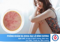 Nổi mụn nhọt vùng kín là bị gì