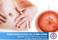 Nổi mụn ở cổ tử cung là bệnh gì