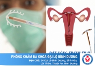 Địa chỉ đặt vòng tránh thai an toàn ở Bình Dương