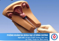 Những điều cần biết khi muốn tháo vòng tránh thai