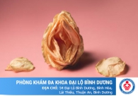 Hình ảnh cô bé bị thâm đen thì làm hồng bằng cách nào hiệu quả và giá hợp lý nhất?