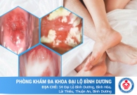 Đừng để quan hệ đau rát biến cuộc yêu thành cực hình