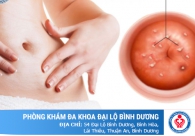 Tất tần tật về bệnh nang naboth cổ tử cung