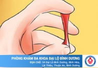 Bị ra máu khi quan hệ là sao?
