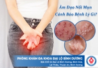 Âm đạo nổi mụn cảnh báo bệnh lý gì?
