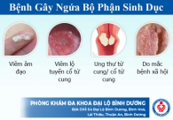 Ngứa bộ phận sinh dục là dấu hiệu bệnh gì