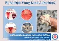 Bị bã đậu vùng kín là do đâu?