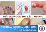 Khí hư bất thường là gì
