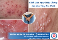 Cảnh Giác Ngay Triệu Chứng Nổi Mụn Vùng Kín Ở Nữ
