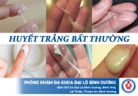 Cảnh báo triệu chứng huyết trắng ra nhiều và ngứa ở vùng kín