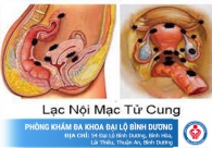 Lạc nội mạc tử cung là bệnh gì