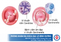 Sưng âm đạo do đâu cách chữa như thế nào?