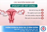 Nguyên nhân và nguy hại của Polyp cổ tử cung đối với sức khỏe nữ giới