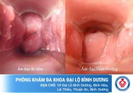 Quan hệ bị chảy máu - Nguy hiểm chớ coi thường